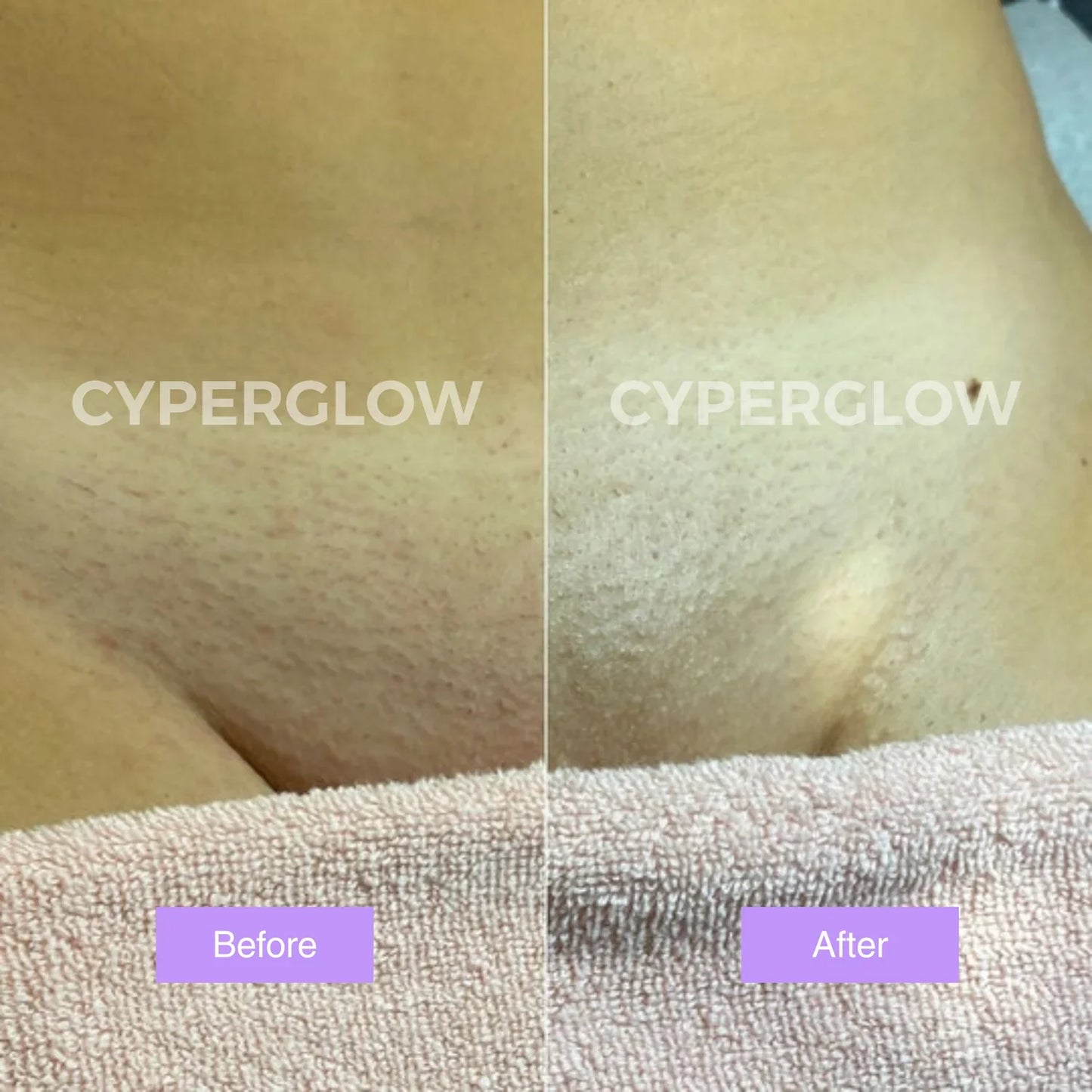 CyperGlow™ - Suero para la piel Cyperus Rotundus