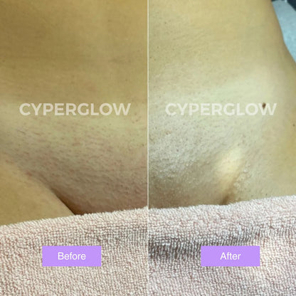 CyperGlow™ - Suero para la piel Cyperus Rotundus