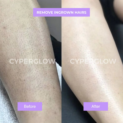 CyperGlow™ - Suero para la piel Cyperus Rotundus