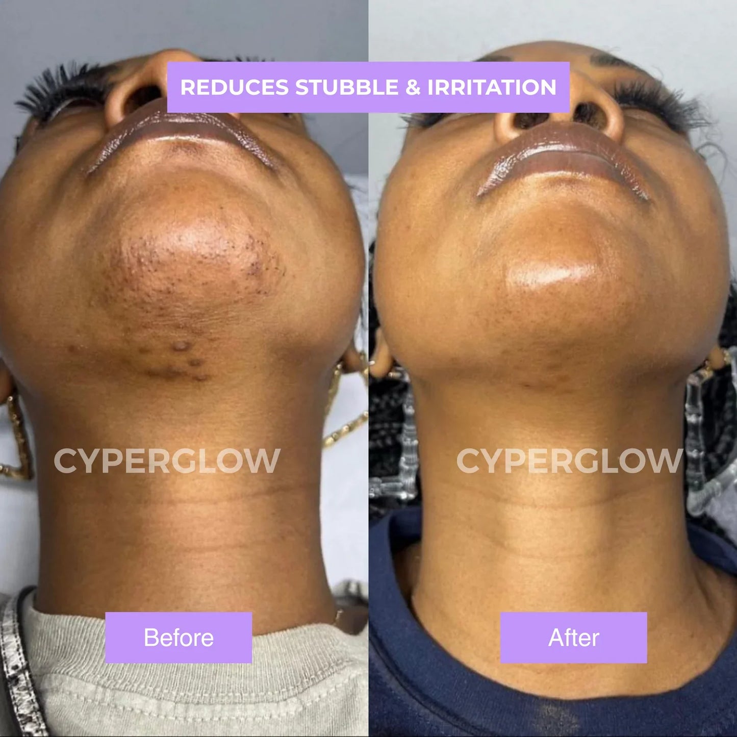 CyperGlow™ - Suero para la piel Cyperus Rotundus