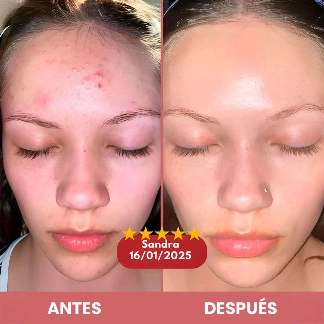 Glow Rice Duo – Exfoliación + Hidratación