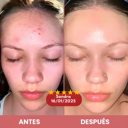 Glow Rice Duo – Exfoliación + Hidratación