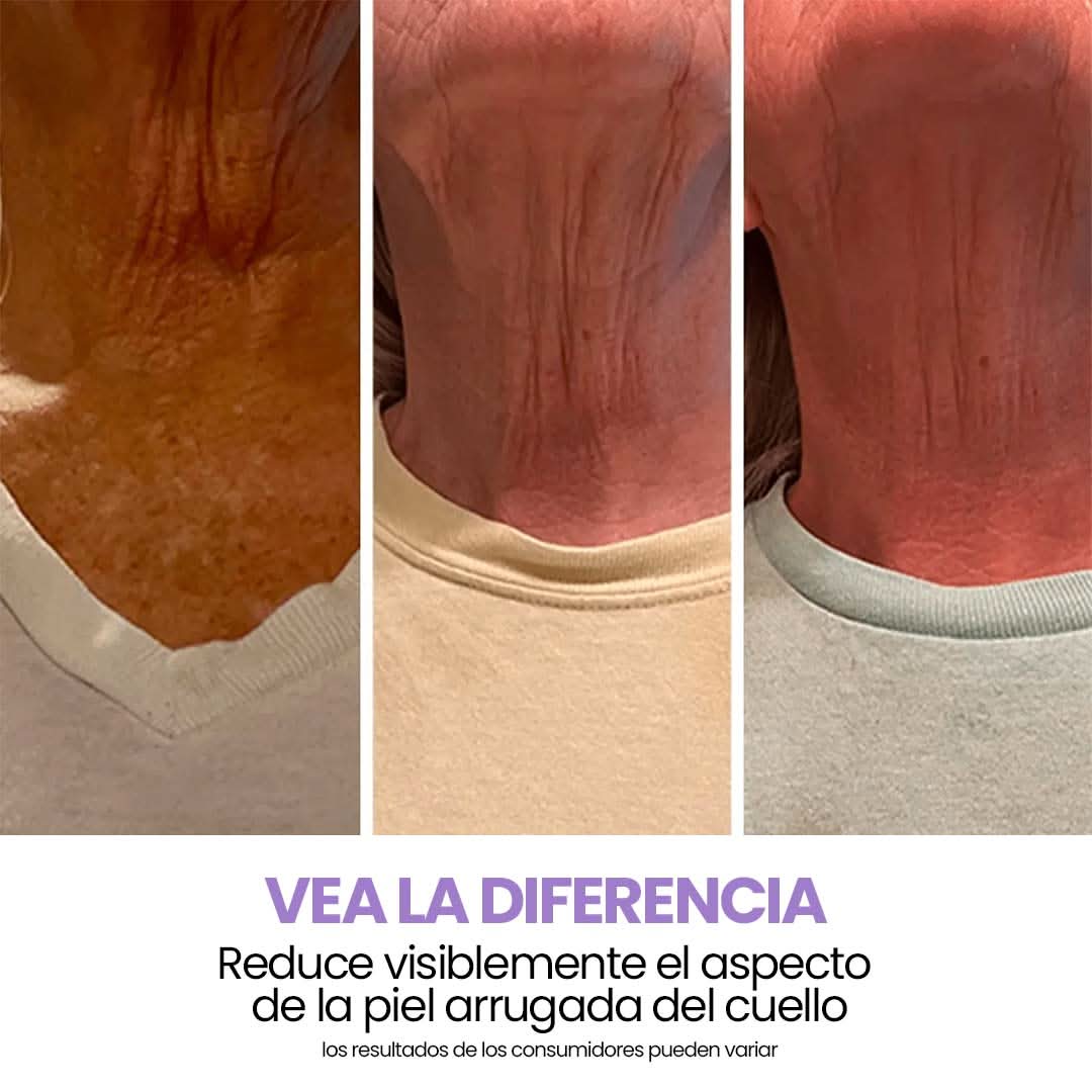 Elypse™ Neck Cream – Reafirma, Eleva y Rejuvenece tu Cuello