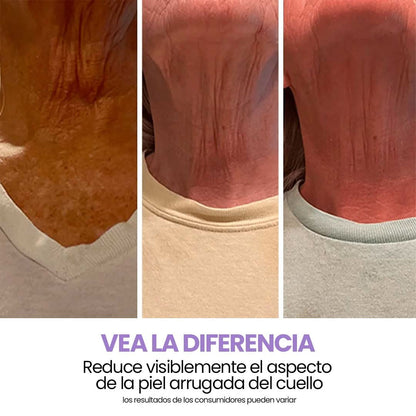 Elypse™ Neck Cream – Reafirma, Eleva y Rejuvenece tu Cuello