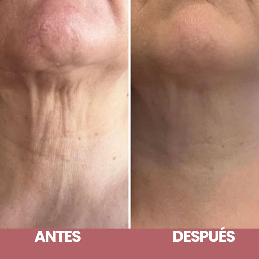 Elypse™ Neck Cream – Reafirma, Eleva y Rejuvenece tu Cuello