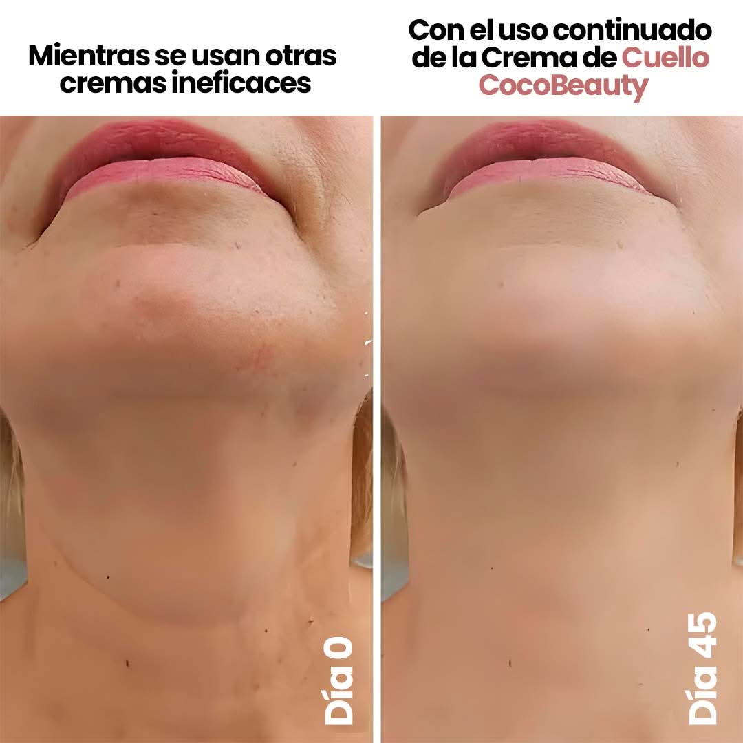 Elypse™ Neck Cream – Reafirma, Eleva y Rejuvenece tu Cuello