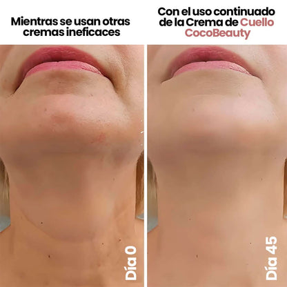 Elypse™ Neck Cream – Reafirma, Eleva y Rejuvenece tu Cuello