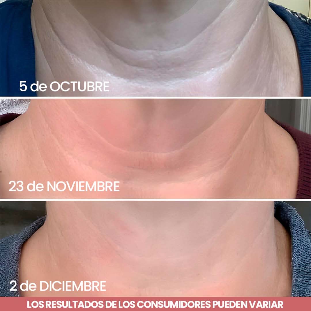 Elypse™ Neck Cream – Reafirma, Eleva y Rejuvenece tu Cuello