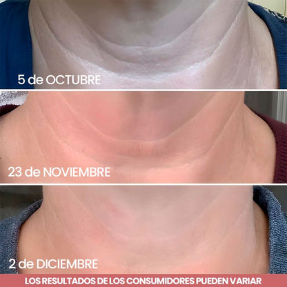 Elypse™ Neck Cream – Reafirma, Eleva y Rejuvenece tu Cuello