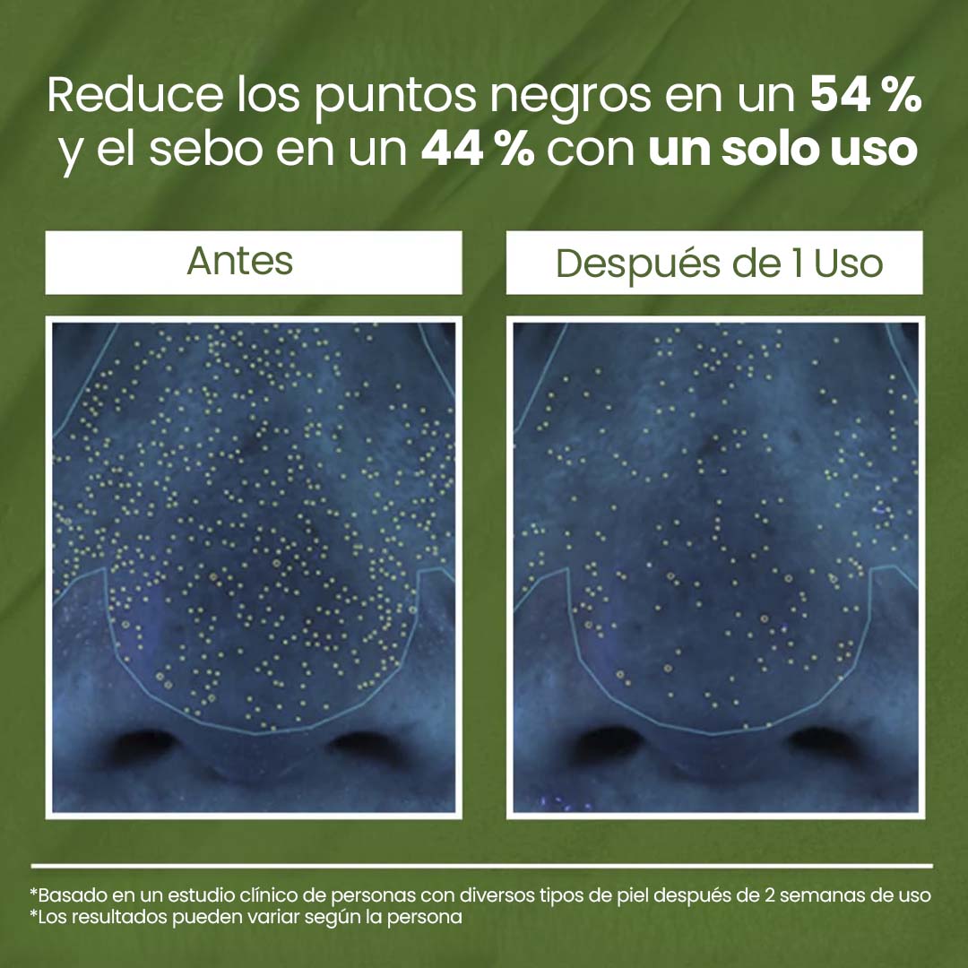 Bubbly® - Mascarilla de Burbujas de Albahaca