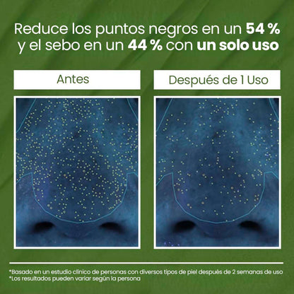 Bubbly® - Mascarilla de Burbujas de Albahaca